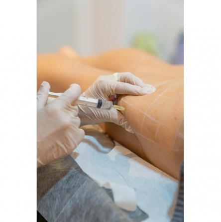 Fusión Silueta Total