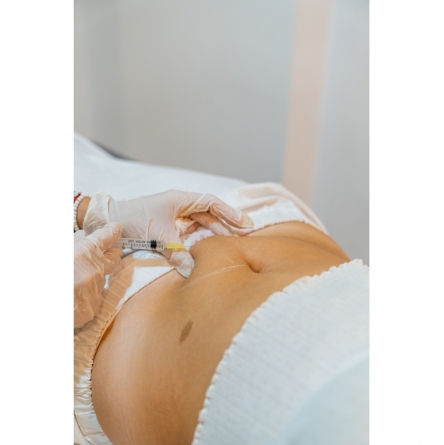 Coolsculpting
